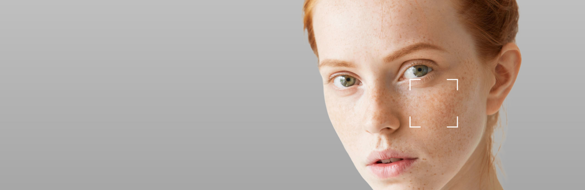 Dry and Dehydrated Skin
