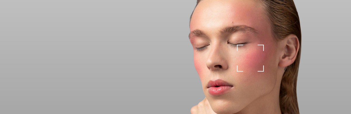 Sensitive Skin