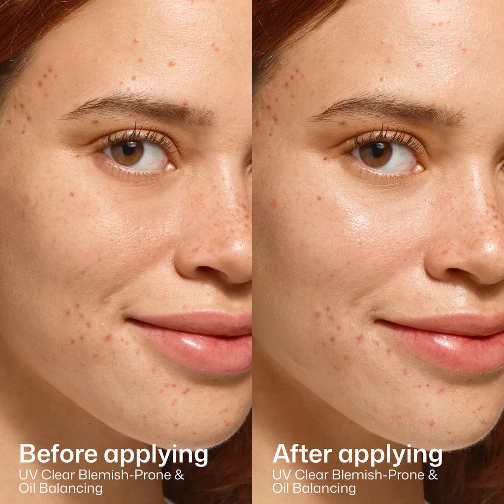EltaMD - UV Clear Blemish-Prone & Oil Balancing SPF 50