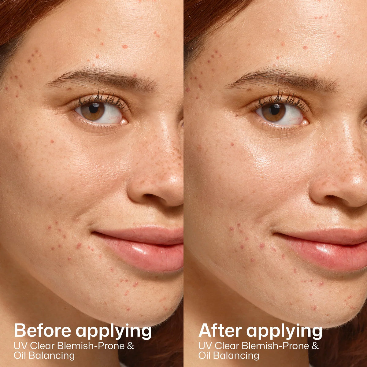 EltaMD - UV Clear Blemish-Prone & Oil Balancing SPF 50