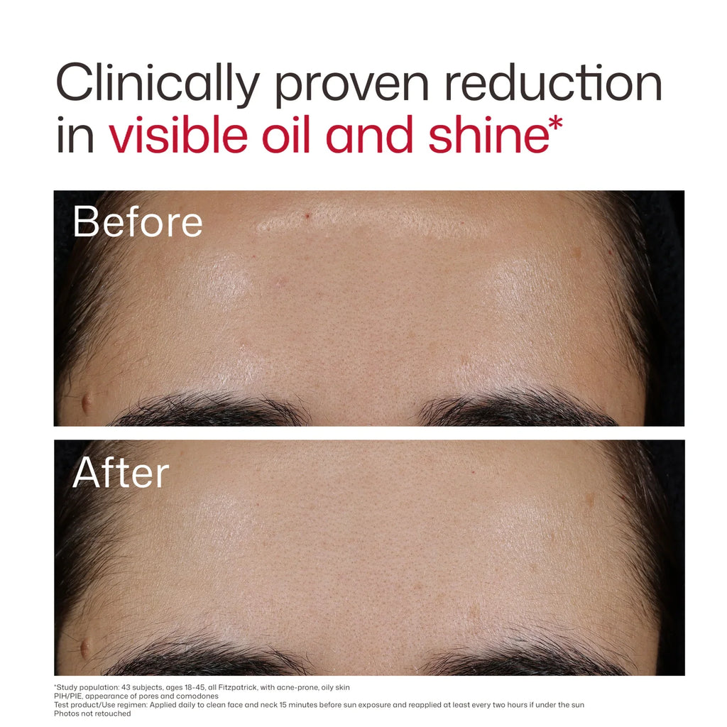 EltaMD - UV Clear Blemish-Prone & Oil Balancing SPF 50