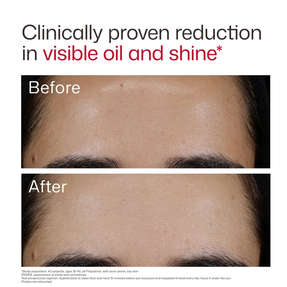 EltaMD - UV Clear Blemish-Prone & Oil Balancing SPF 50