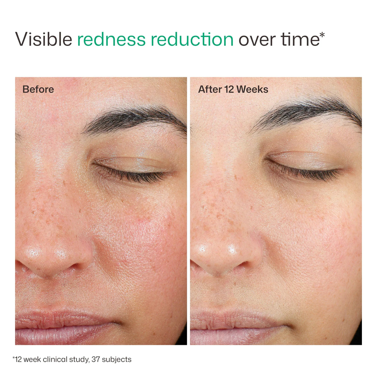 EltaMD - UV Skin Recovery Red Color Correcting Green Tint Broad Spectrum SPF 50
