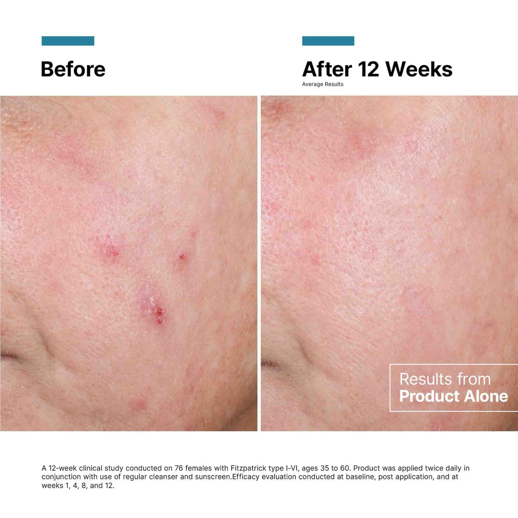 SkinCeuticals - Advanced RGN-6