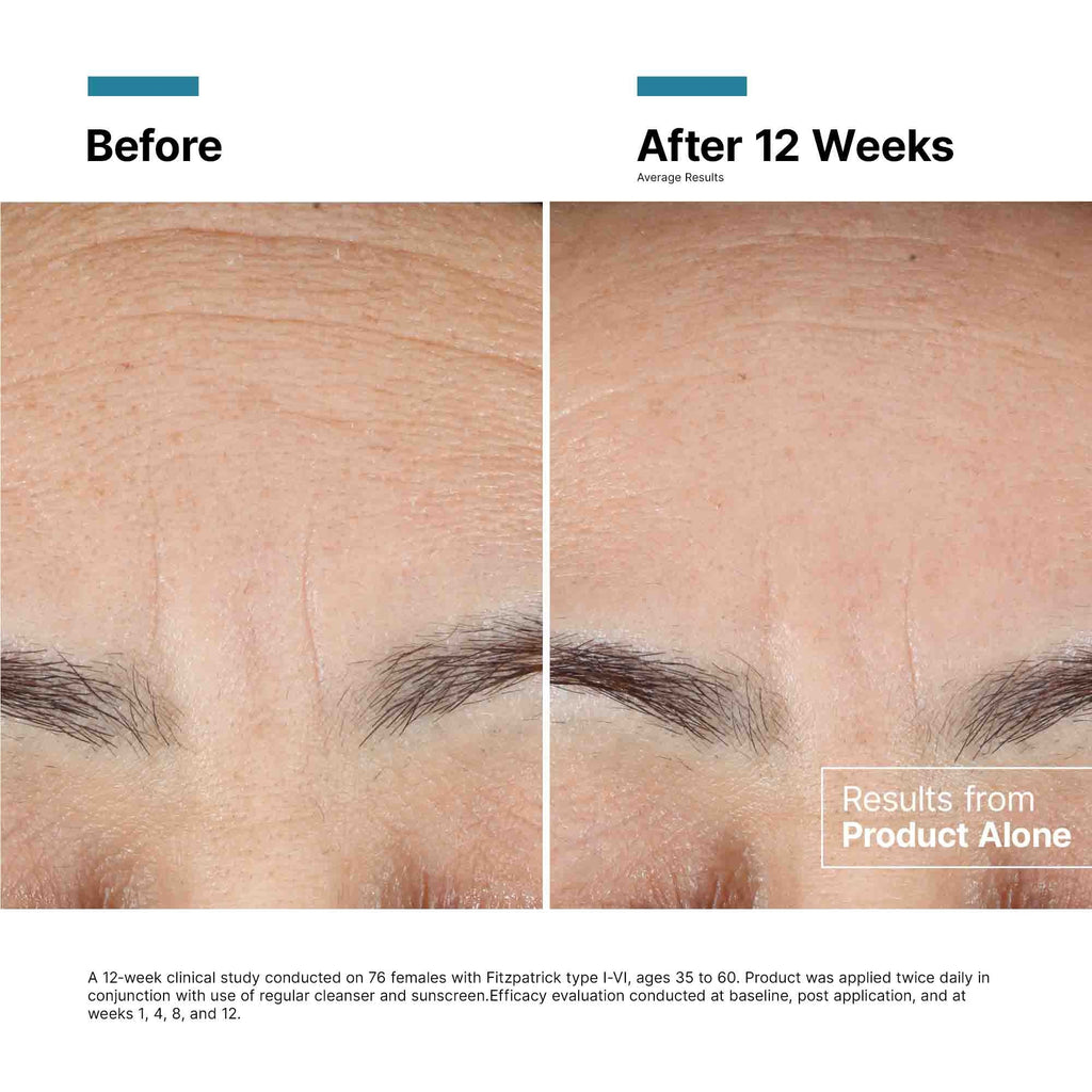 SkinCeuticals - Advanced RGN-6