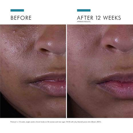 SkinCeuticals - Silymarin CF