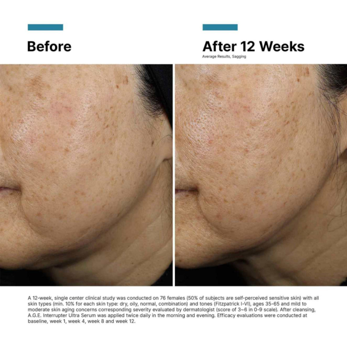 SkinCeuticals - A.G.E. Interrupter Ultra Serum